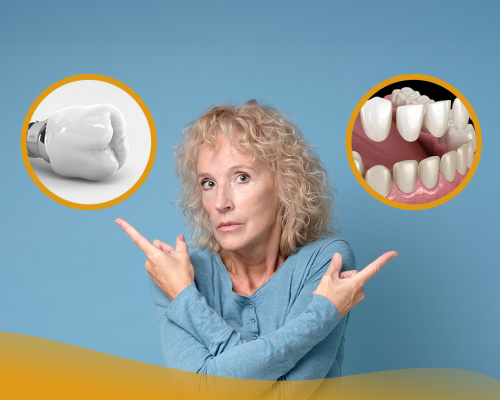 Facette dentaire ou couronne : quelle est la différence et quand choisir l’une ou l’autre ?